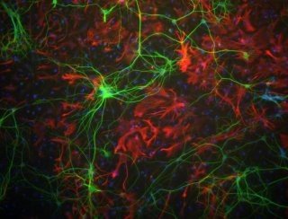 Photo of primary culture from a rat neocortex showing neurons (in green), glial cells (in red), and nuclei (in blue) grown in vitro. Credit: Bill Mundy, US EPA, retired.