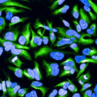 Neuronal cells prepared and imaged by Megan Culbreth using the Opera Phenix High-Content Screening System, showing nuclei (blue) and nestin (green). Data from images like this are generated to evaluate chemically-induced changes in neurodevelopment for DNT in vitro assays, which Kelly Carstens uses to build predictive models.